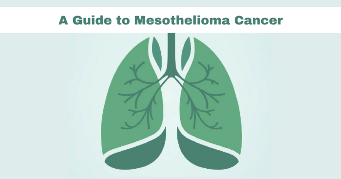 Peritoneal Mesothelioma: Causes, Symptoms and Treatment Options
